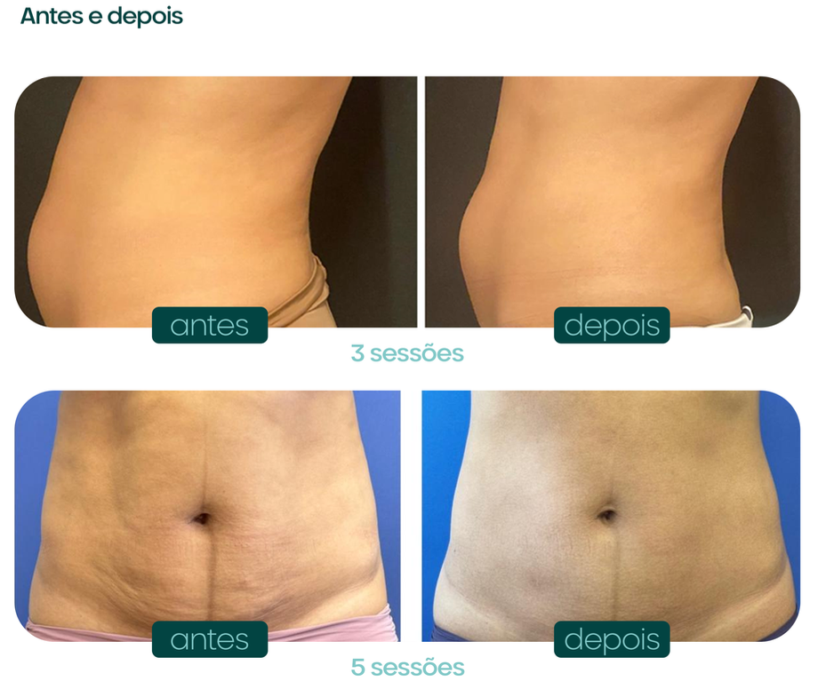 Captura de Tela 2025-06-04 às 16.11.26