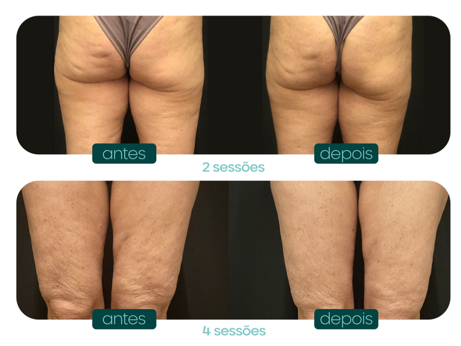 Captura de Tela 2025-06-04 às 16.11.34