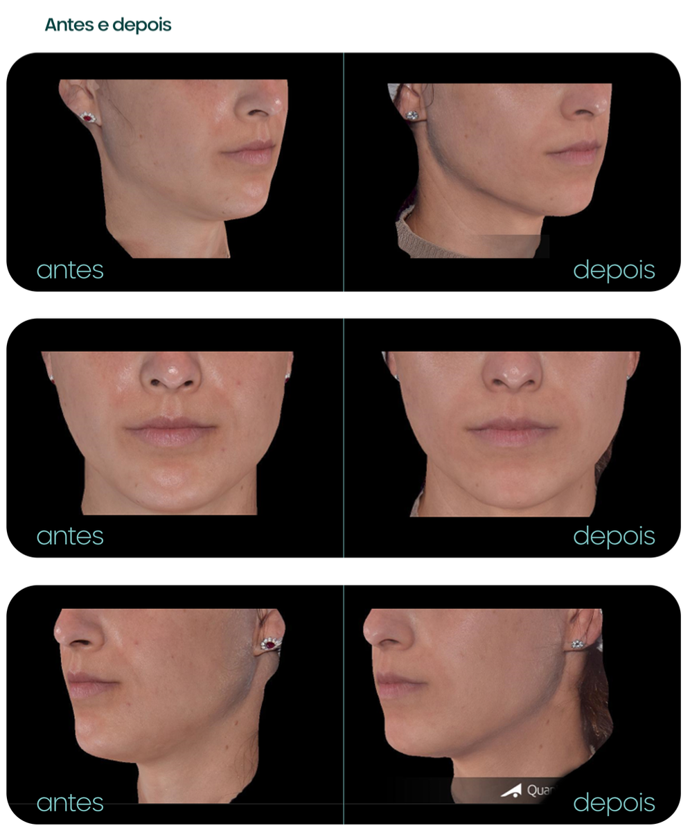 Captura de Tela 2025-06-04 às 16.11.56