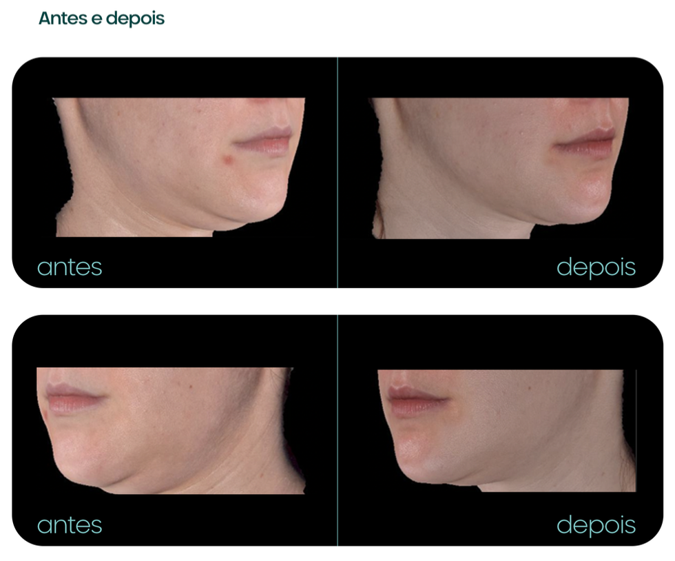 Captura de Tela 2025-06-04 às 16.12.05